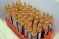 Массовое тестирование москвичей на иммунитет к коронавирусу начнется 15 мая