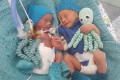Медики роддома спасли недоношенных братьев-двойняшек